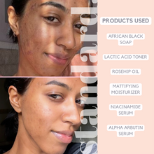 Mattifying Gel Moisturiser With 10% Azelaic Acid